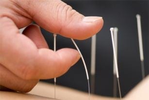 Acupuncture – restoring the balance